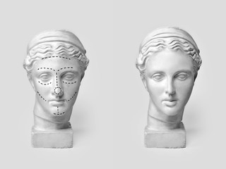 Two marble heads of young women, ancient Greek goddess bust marked with lines for plastic surgery...