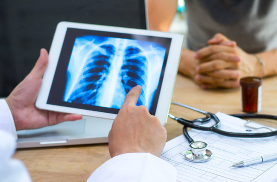 Doctor shows results to old patient x-ray of the lungs, smoking cigarettes problem - Powered by Adobe
