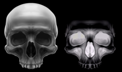 Fluorescent X-ray and grey detailed human skull on black background illustration set