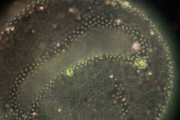 Volvox in drop of water under the microscopic view