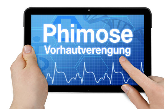 Tablet mit Diagnose Phimose Vorhautverengung