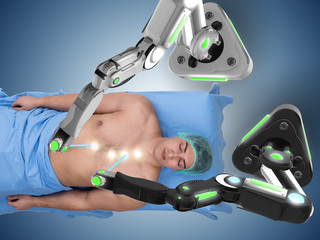 Surgery performed by robotic arm