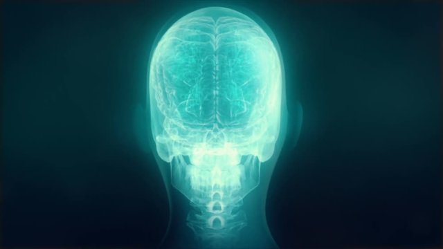 X-Ray of human head series.