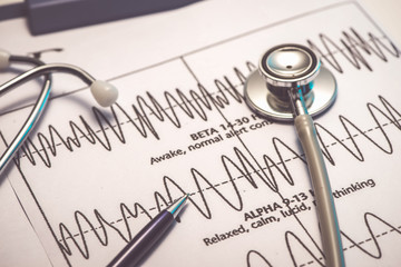 Cardiogram pulse trace and stethoscope concept for cardiovascular medical exam