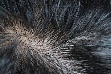 Closeup head with hair and scalp