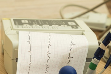Paper with electrocardiogram in the ECG machine