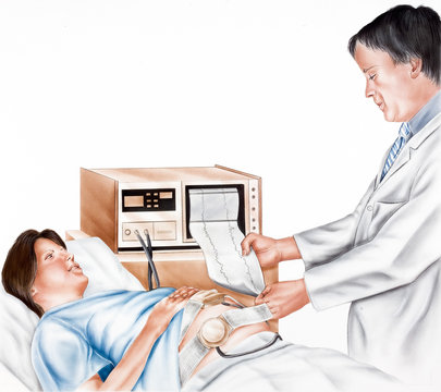 Pregnancy - Fetal Monitoring allowing continuous evaluation of a fetus. Monitoring can give early warning of fetal distress, and precise management of labor...