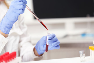 Scientist working with blood sample in laboratory