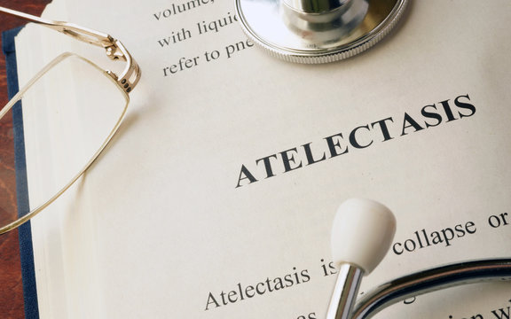 Document with diagnosis atelectasis in a hospital.