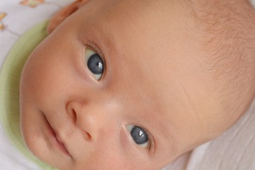 Detail of newborn baby face having  jaundice.