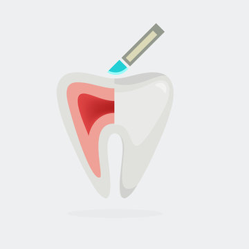 Tooth illustration