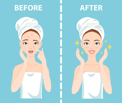 Before-After set of upset troubled and happy woman with female facial skin problems needs to care about: acne, pimples.