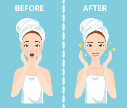 Before-After set of upset troubled and happy woman with female facial skin problems needs to care about: acne, pimples.