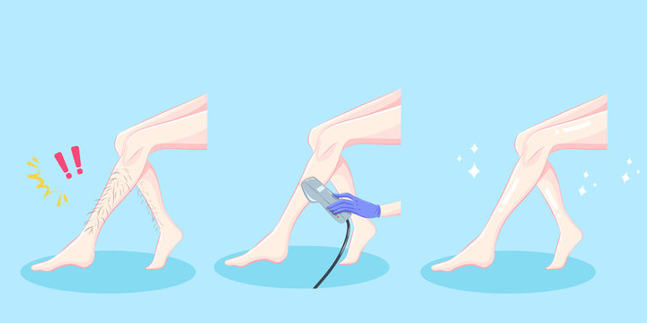 Leg Hair Removal Concept