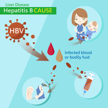 hepatitis b cause