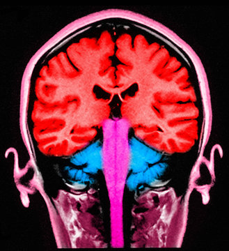 MRI brain sagital section normal