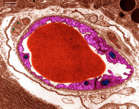 Transmission Electron micrograph pancreas
