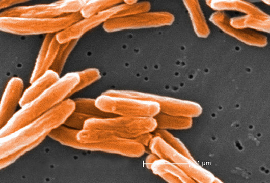 Electron micrograph of Mycobacterium tuberculosis