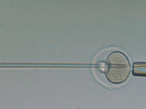 In vitro fertilization of an egg