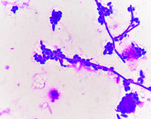Budding yeast cells with pseudohyphae Gram stain method