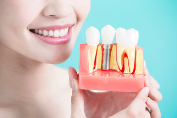 healthy dental concept
