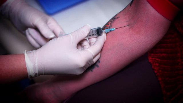 4K Woman Taking Blood for PRP Lifting Treatment