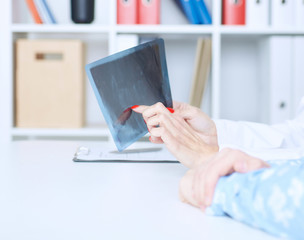Doctor explaining x-ray results to male patient. Only hands on the picture.
