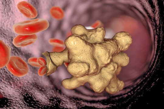 Entamoeba histolytica protozoan in blood. Parasite which causes amoebic dysentery and ulcers, 3D illustration