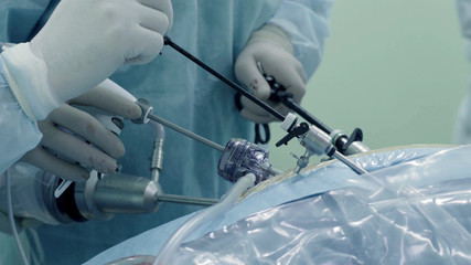 Laparoscopic surgery of the abdomen