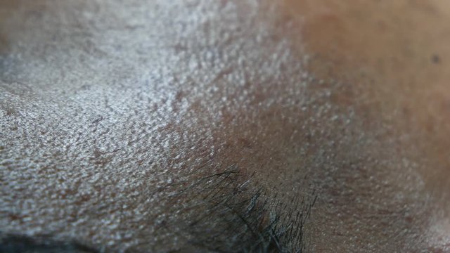 Close up of Human Skin Texture 
