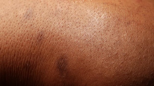 Close up of Human Skin Texture 
