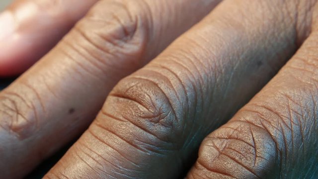 Close up of Human Skin Texture 
