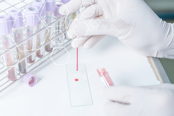 Blood sampling with needle for analysis in laboratory
