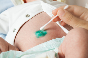 Treatment of the baby's navel