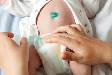 Mom changes the baby's diaper.