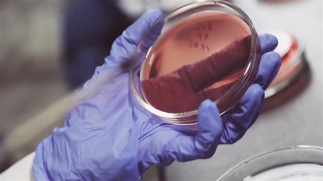 Bacteriological crops of various bacteria and microorganisms are produced by the lab staff in gloves. Dense nutrient media for bacteria. Sowing on special Petri dishes takes place using special needle