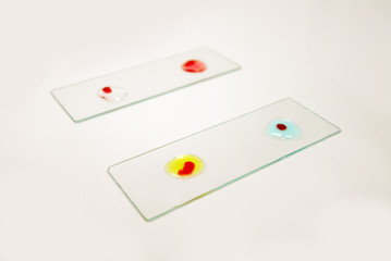 Blood group tasting of an O positive doner, with blood drop before mixing with blood grouping reagent. Selective focus on A group testing.