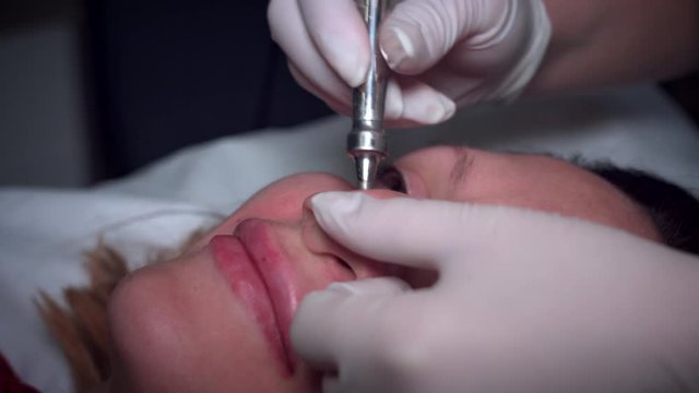 4K Woman Face with Microdermabrasion on Nose