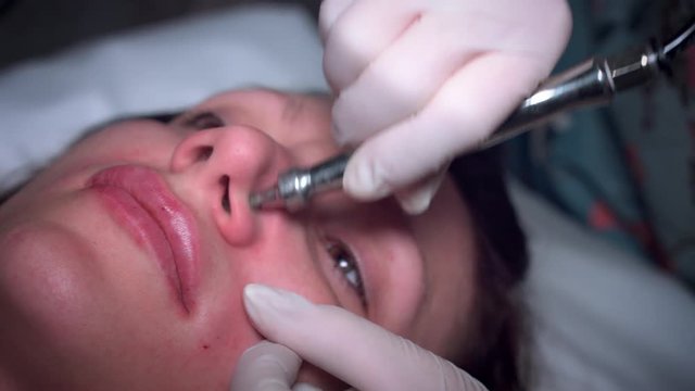4K Woman Face with Microdermabrasion on Nose