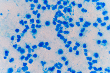 Moderate blue white blood cells.