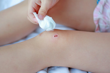 Close Up of child knee with a plaster (for wounds), Selective focus at bandage. Health care and medicine concept.