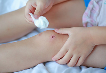 Close Up of child knee with a plaster (for wounds), Selective focus at bandage. Health care and medicine concept.