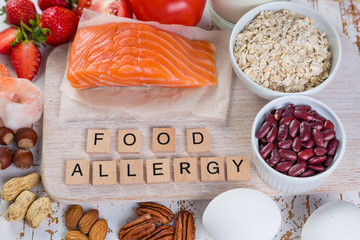 Food allergies - food concept with major allergens