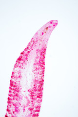 Zeuxapta sp. is platwormen (Platyhelminthes) infection in the gill on slide under microscope view.