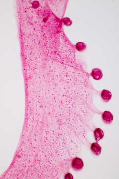 Zeuxapta sp. is platwormen (Platyhelminthes) infection in the gill on slide under microscope view.