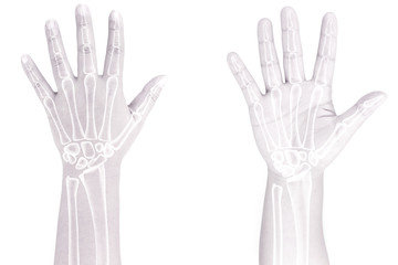 Obraz premium hand bone pain