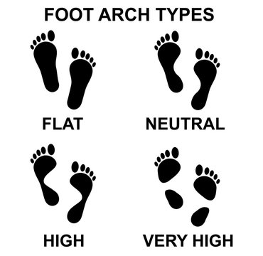 Foot arch types vector icon set.