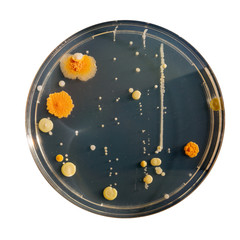petri dish samples with bacteria and fungal colonies