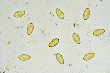 Eggs of Opisthorchis viverrini (Southeast Asian liver fluke) in stool, analyze by microscope