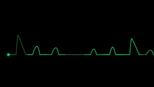 4k ECG Cardiovascular heart monitor showing heartbeat pulse.